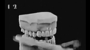 1922 | Thommy Tuckers tooth